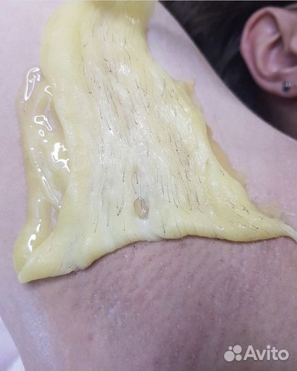 Восковая/сахарная депиляция/эпиляция/шугаринг