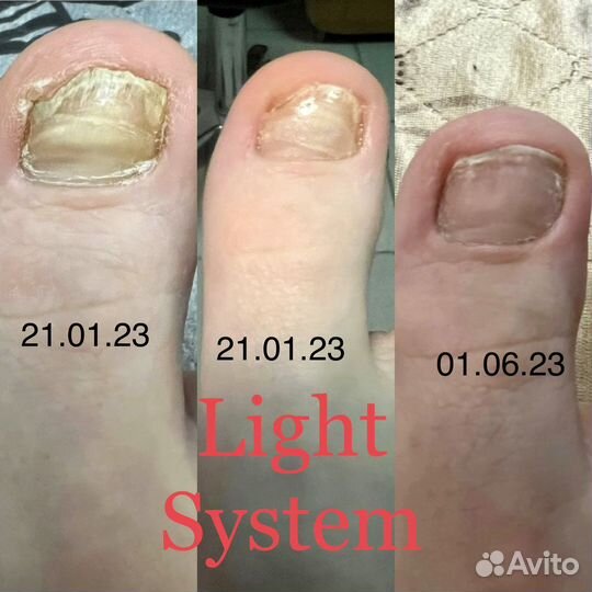 Подолог с выездом на дом