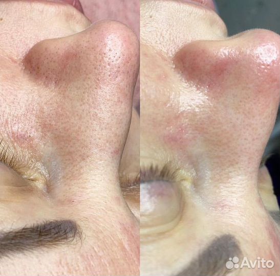 Косметолог Красноармейский