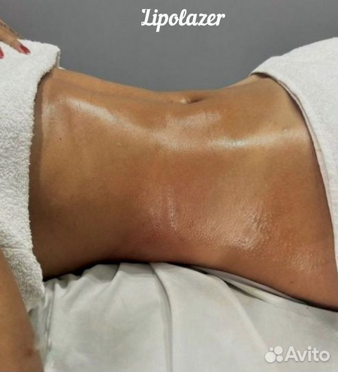 Коррекция силуэта/Липолазер