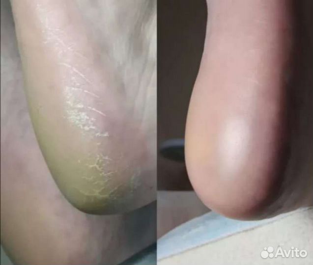 Педикюр Смарт,наращивание ногтей,маникюр