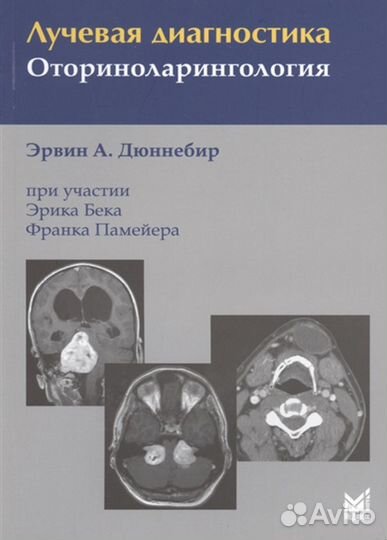 Лучевая диагностика. Оториноларингология