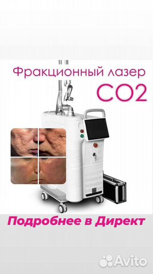 Со2 лазер Лазерная шлифовка