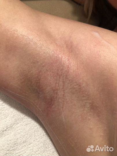 Spa-шугаринг