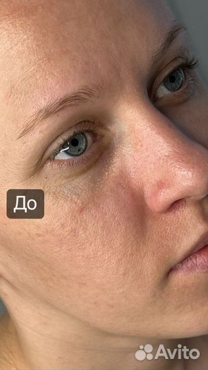Архитектура бровей