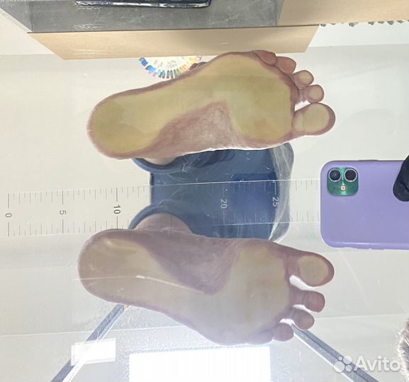 Изготовление индивидуальных ортопедических стелек