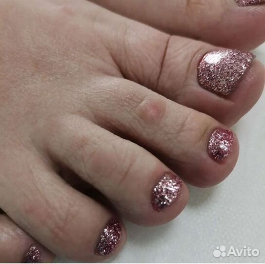 Педикюр (подолог)