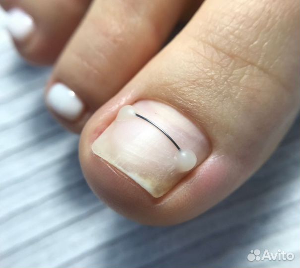 Подолог,выезд круглосуточно 24/7