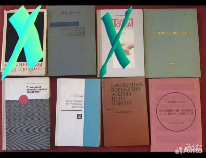 Неврология. Книги