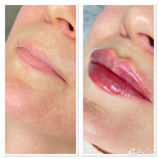 Массаж лица, косметолог