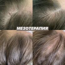 Косметолог, Малаховка