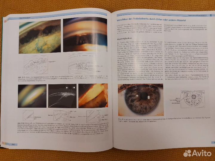 Atlas der Klinischen Ophthalmologie (офтальмология