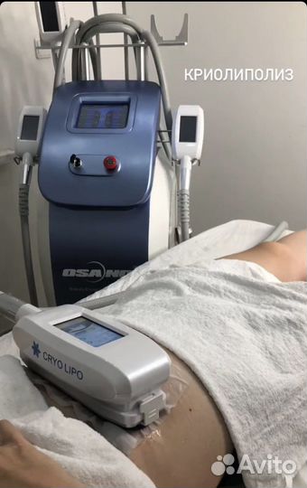 Криолиполиз