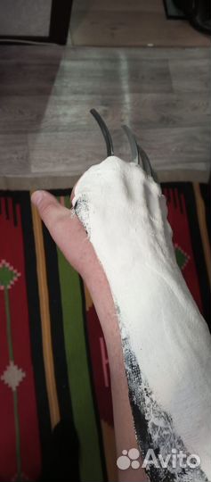 Лангетка на правую руку