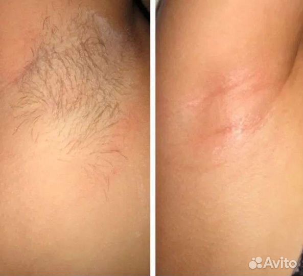 Массаж и депиляция