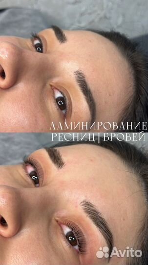 Брови Ресницы