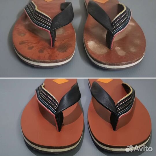 Реставрация кожи 