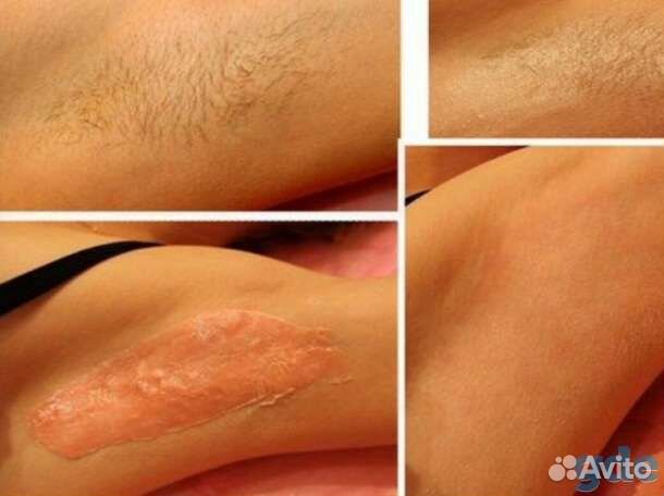 Массаж и депиляция