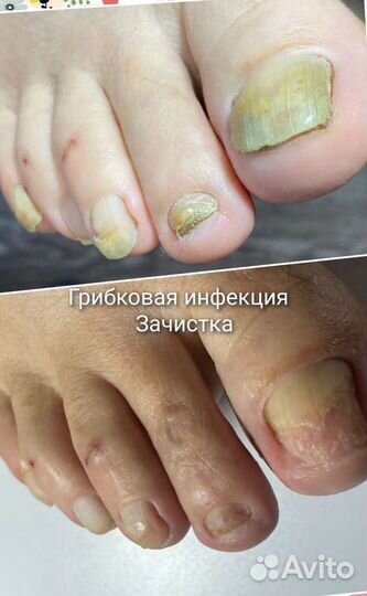 Маникюр, педикюр