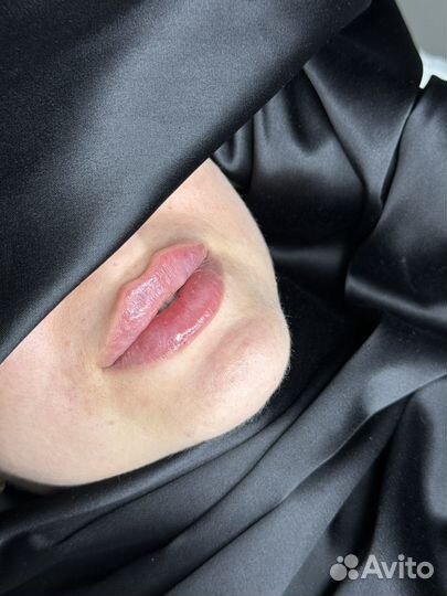 Увеличение губ