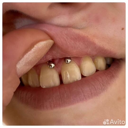 Пирсинг, микродермал