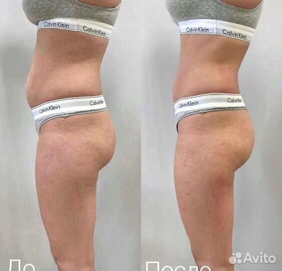 Аппаратный массаж комплексы для похудения