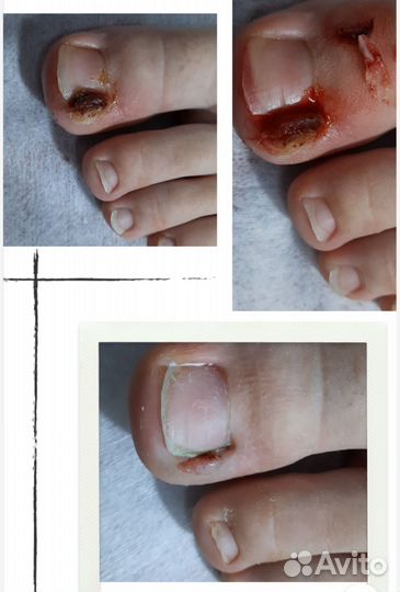 Подолог-педикюр