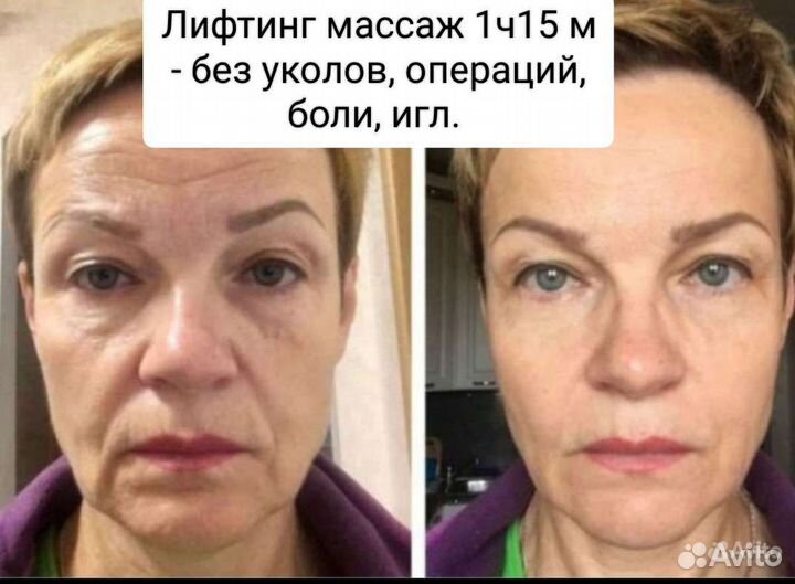Лифтинг Массаж лица от Елены Бондаренко