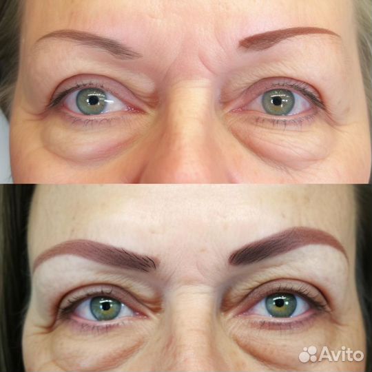 Кабинет профессионального удаления татуажа