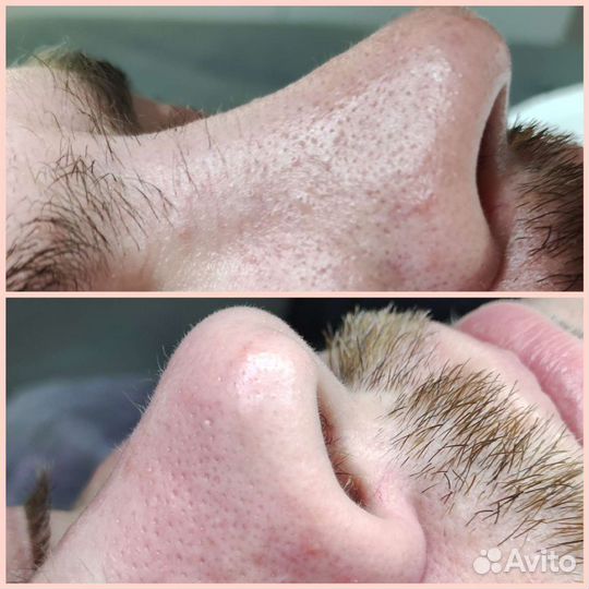 Косметолог (чистка лица, пилинг, маски)