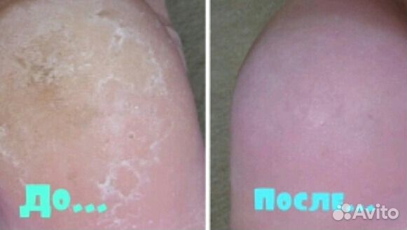 Педикюр и маникюр опыт работы мастера более 15 лет