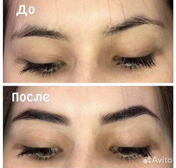 Брови