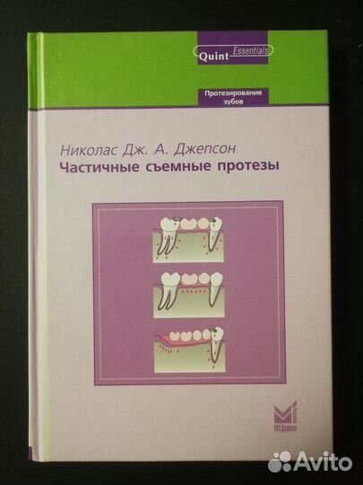Джепсон Н. Частичные съемные протезы