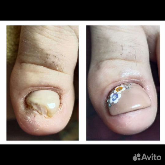 Маникюр педикюр с выездом. Девяткино