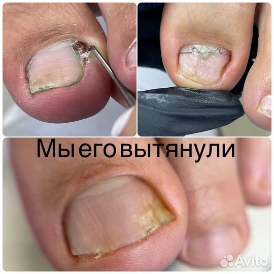 Модель к подологу