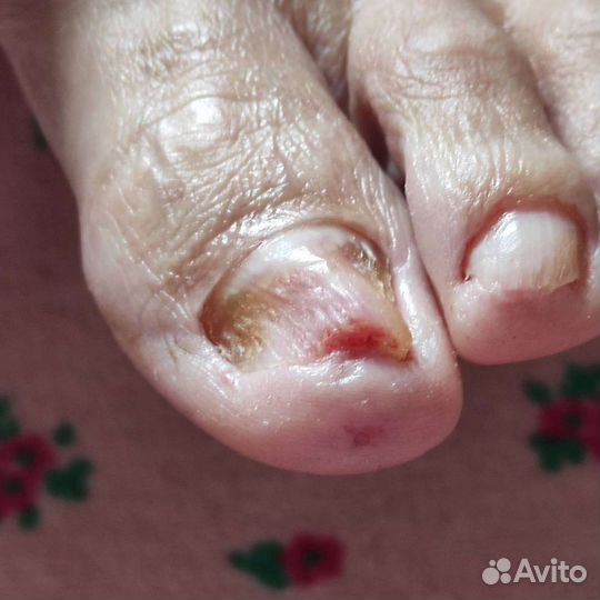 Педикюр с выездом для пожилых