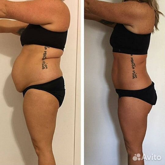 Коррекция фигуры, похудение