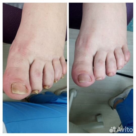 Подология и эстетический педикюр, маникюр, подолог