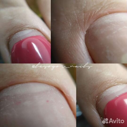 Smart педикюр 