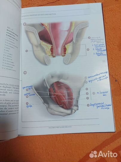Хирургия рака прямой кишки