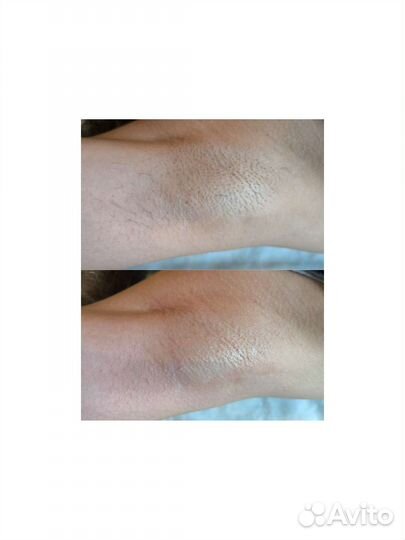 Массаж Шугаринг Чебоксары сзр Афанасьева