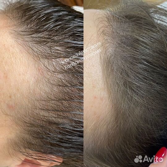 Холодная плазма обучение