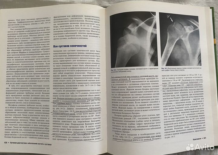 Лучевая диагностика заболеваний костей и суставов