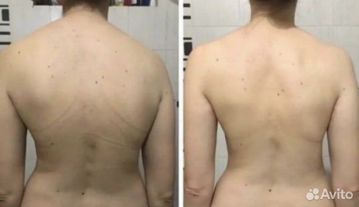 Биоэнергомассаж бэм Fohow