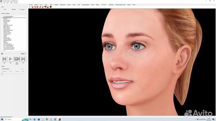 Invivo Dental 7.1 full 2023