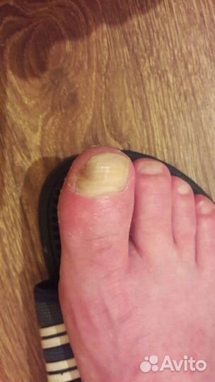 Желудочный сок Гюрзы 10%