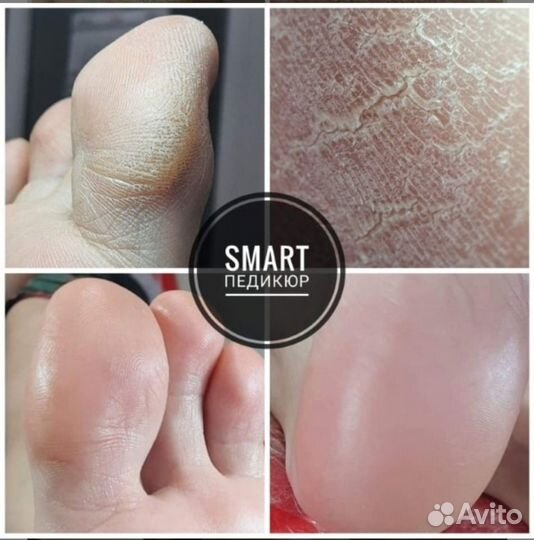 Маникюр и педикюр