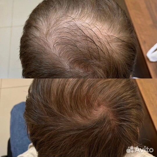 Шампунь /сыворотка для активного роста волос