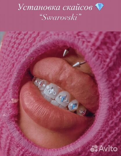 Скайсы и обучение установки скайсам