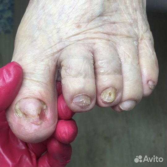 Модель на педикюр